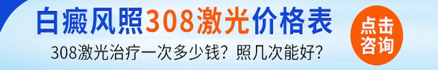 兰州银屑病医院